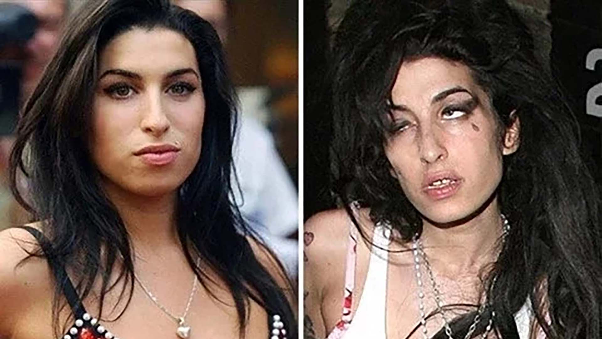 Famosos que perderam para as Drogas.